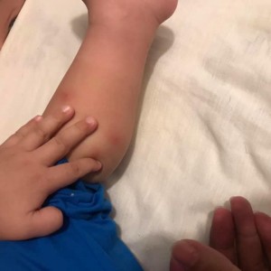 小朋友被毒蚊子咬, 用薰衣草啦！（中國市場）